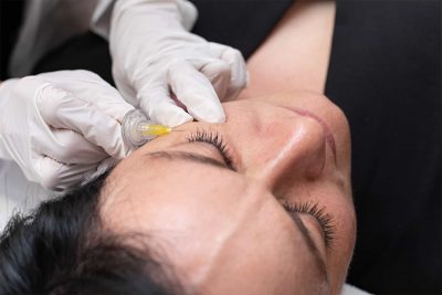 کربوکسی تراپی1 کربوکسی تراپی1